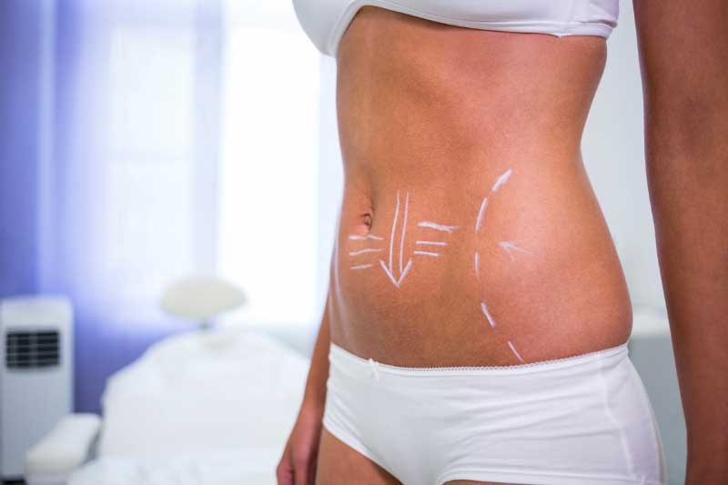 6 Reasons Why Sculpting Machines Are So Popular For Fat Reduction