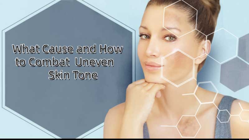 Understanding the Causes of Uneven Skin Tone and How to Combat Them