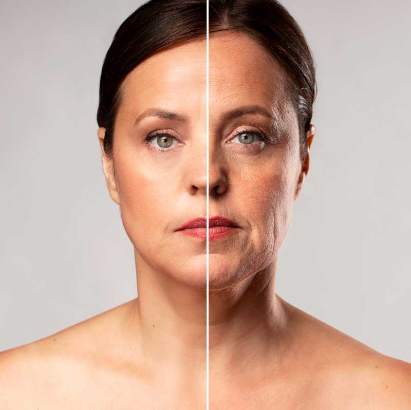 What is meant by the premature skin aging process?