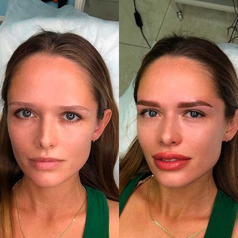 Techniques populaires de maquillage permanent