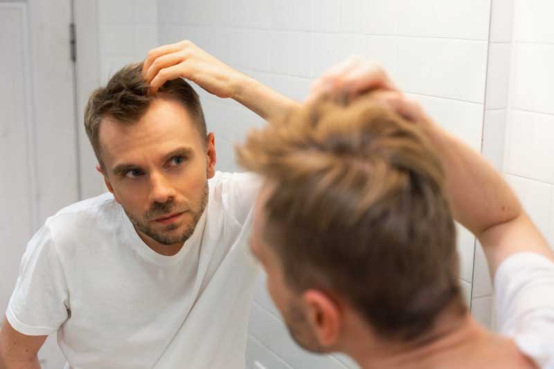 Common Causes of Male Hair Loss & Best Treatments