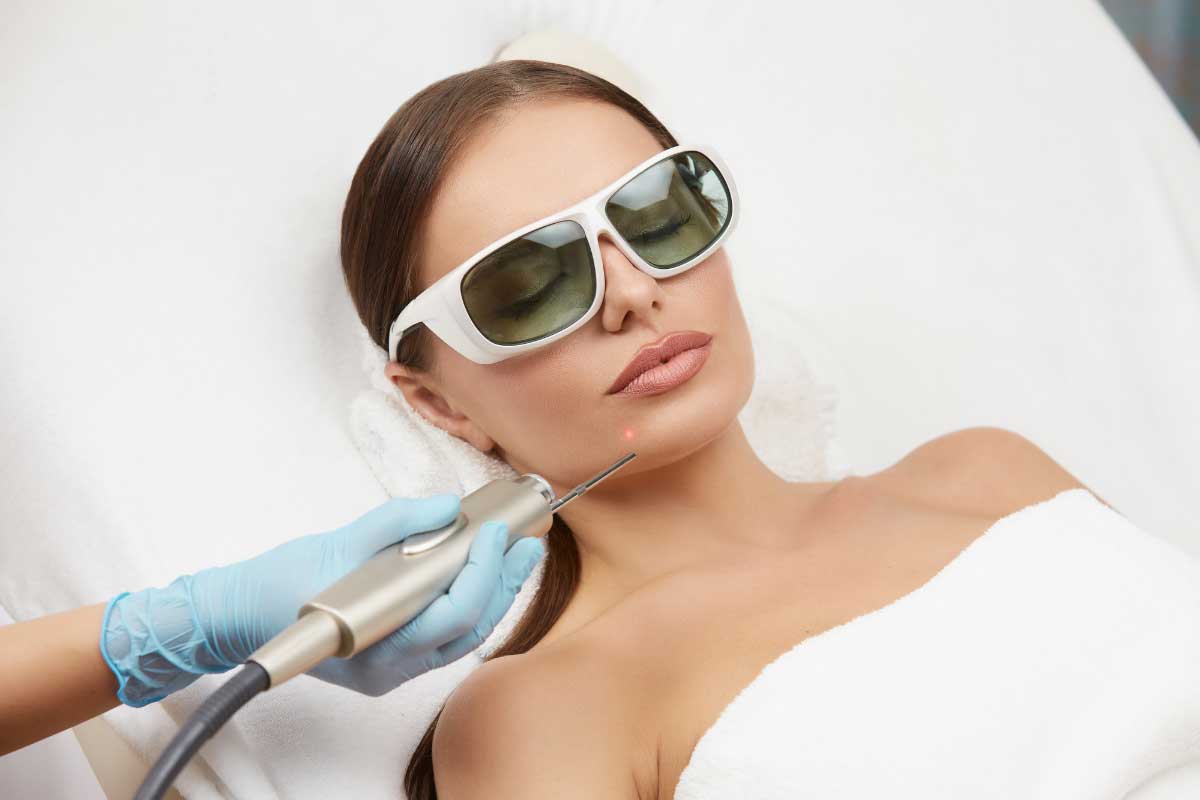 Tips for Choosing the Right Hair Removal Service