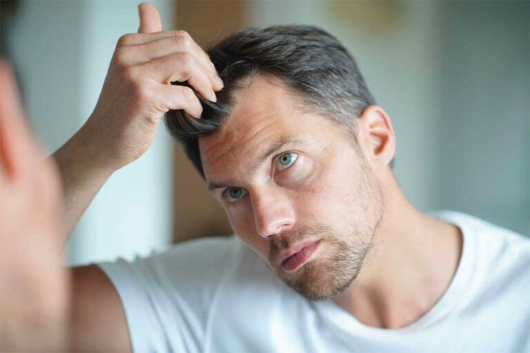 Comment stopper et prévenir les cheveux gris naturellement ?
