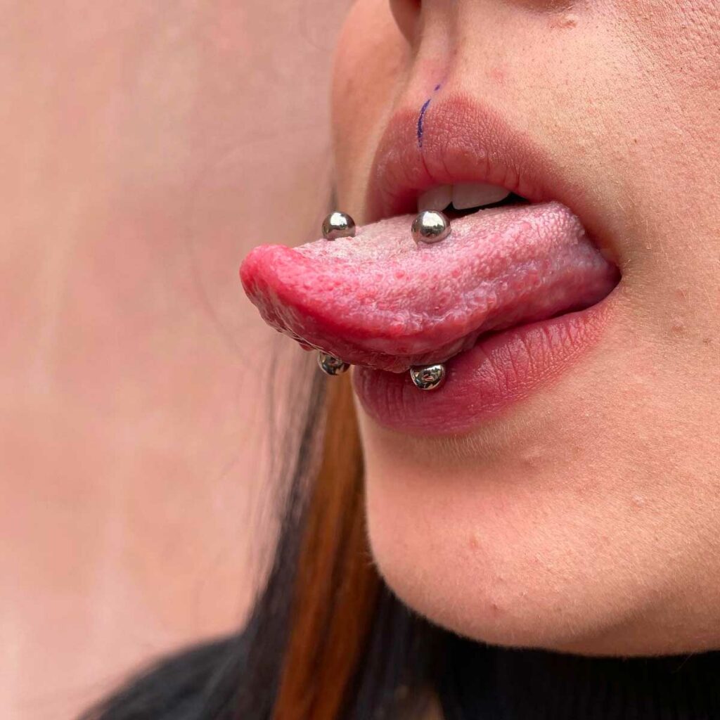 piercing double langue guéri
