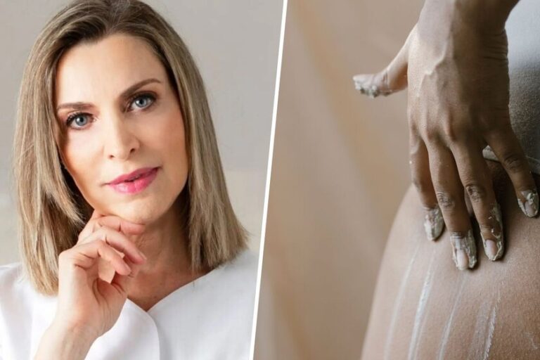 Carmen Martín, experte en dermocosmétique : "Pour traiter les vergetures, en complément des soins en cabine, je vous conseille le bidon bleu Nivea pour hydrater et réparer"